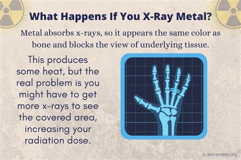 x ray metal meaning